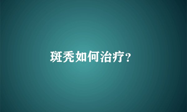 斑秃如何治疗？