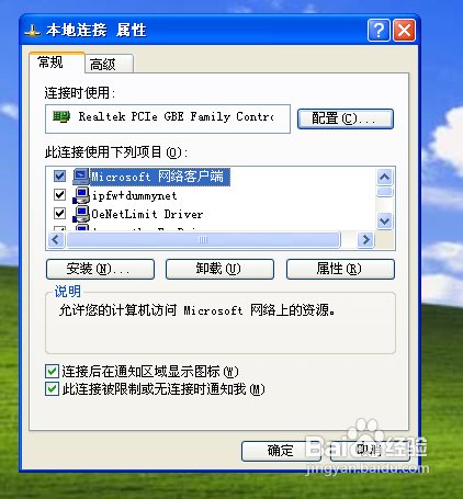 怎么设置本地连接