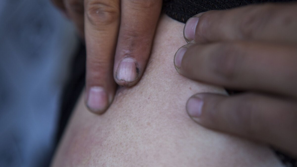 女生军训被马蜂爬嘴一动不动，遇到这种情况该怎么办？