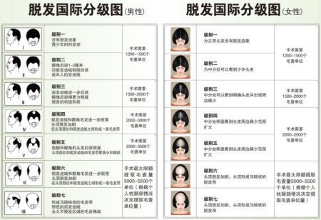 植发的价格一般贵不贵