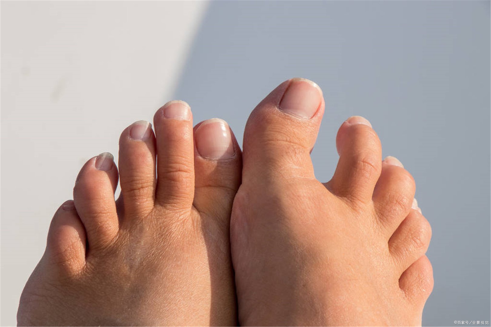 右脚底有痣代表什么？