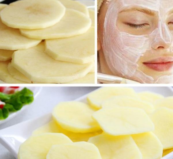 什么是真皮斑呢