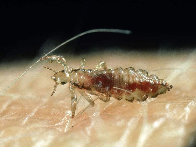 虱子是怎么产生的