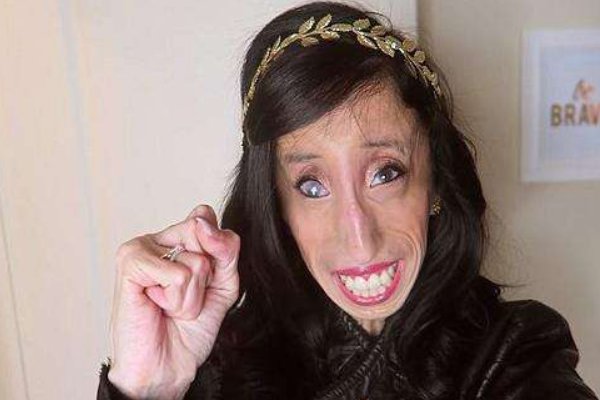 世界上最瘦的人是谁?