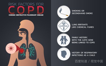 肺气肿能治好吗?