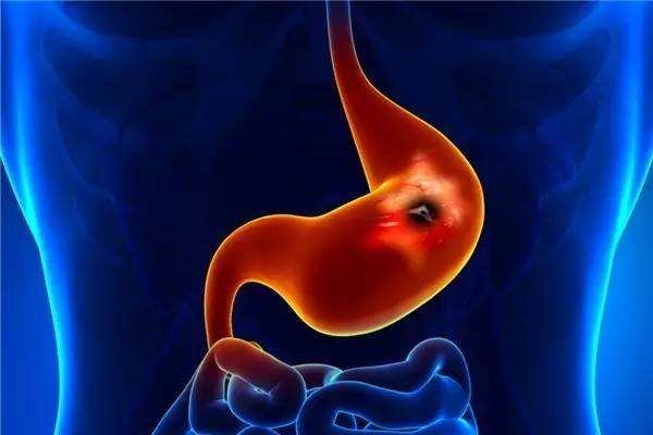 胃痛怎么办 有没有快速止痛的方法