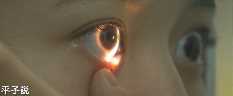 近视眼的治疗方法？