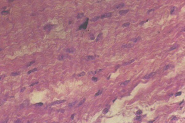 简述什么叫苏木精-伊红染色法