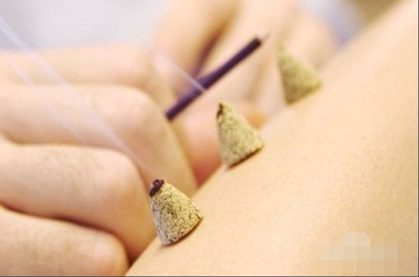 艾条怎么使用？