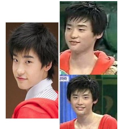 李钟硕承认过自己整容吗?