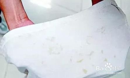 衣服弄上荔枝水,怎么洗掉?