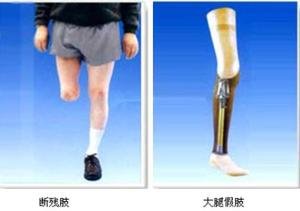 装假肢要注意什么?