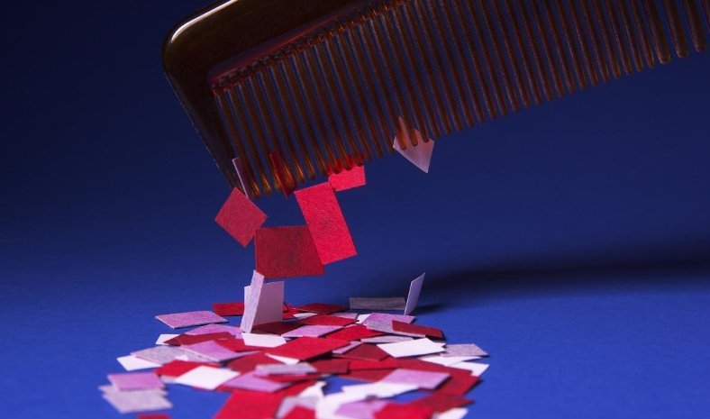 身上老是有静电怎么办？