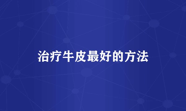 治疗牛皮最好的方法