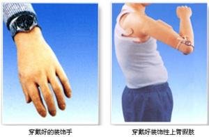 装假肢要注意什么?