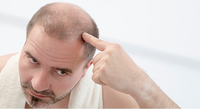 掉头发很厉害是为什么？