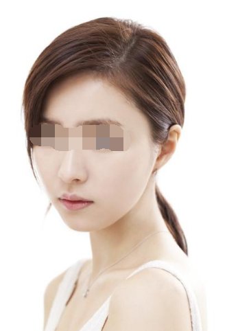 彩光嫩肤要多少钱