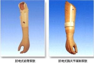 装假肢要注意什么?