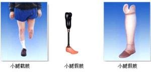 装假肢要注意什么?