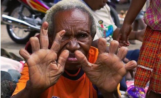 为何达尼族要在亲人去世的时候切断自己的一截手指头？