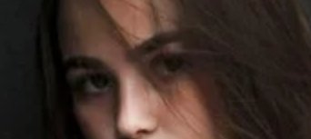 大鼻头如何缩小