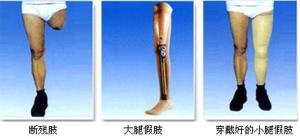 装假肢要注意什么?