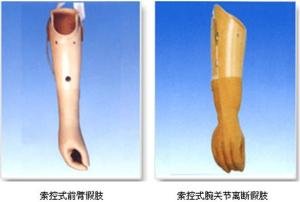 装假肢要注意什么?