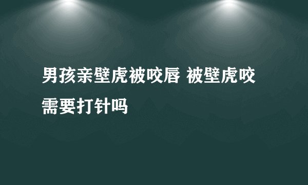 男孩亲壁虎被咬唇 被壁虎咬需要打针吗