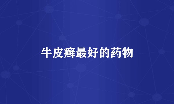 牛皮癣最好的药物