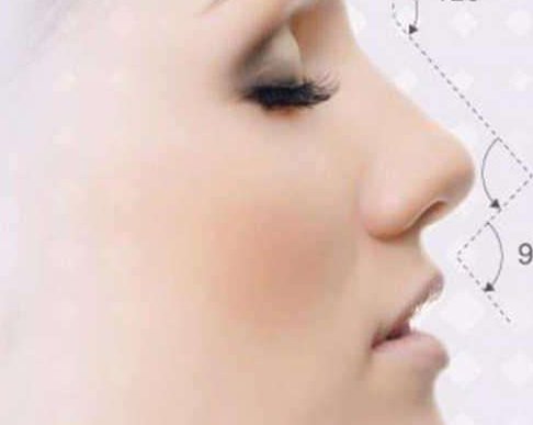 假体隆鼻的优势有哪些