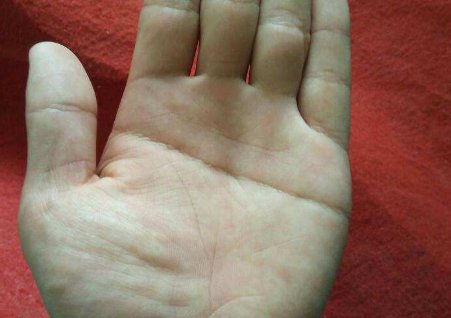 男孩子断掌代表什么意思？