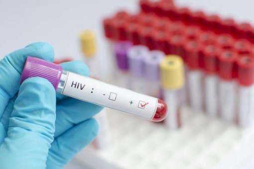 去疾控中心检测艾滋，实名登记的话会怎么样？？