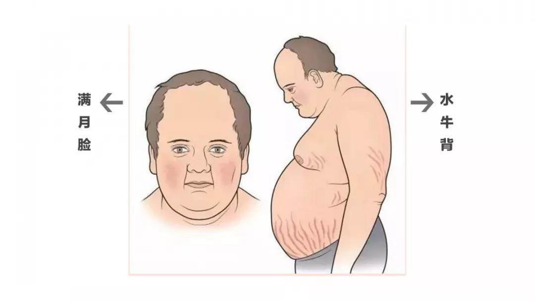 满月脸是什么？