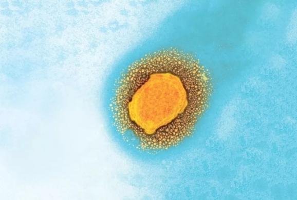 猴痘病毒会成为下一个“天花”吗?猴痘与天花有什么区别?