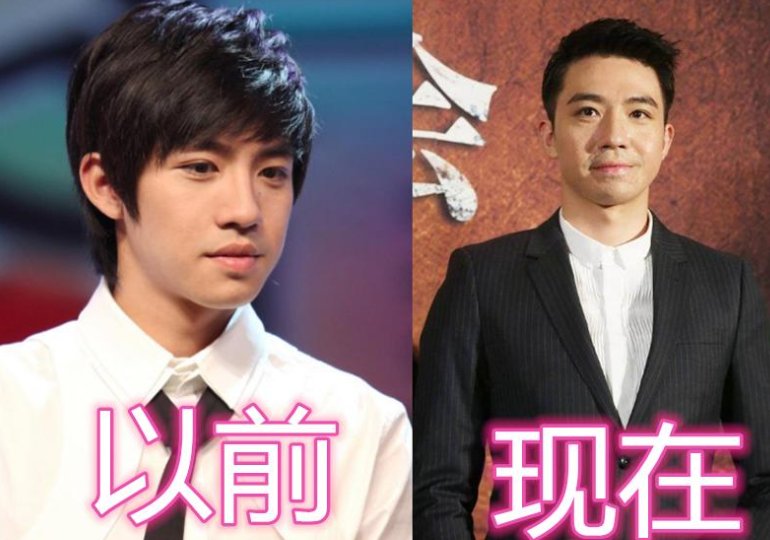 俞灏明烧伤前后对比是怎样的？