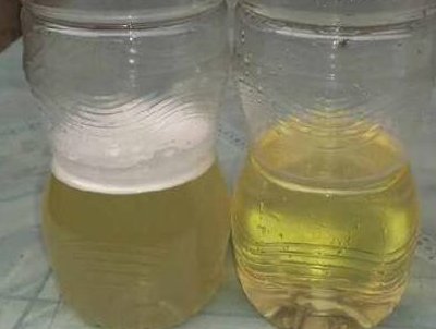 怎么用最简单的方法辨别蜂蜜的真假？