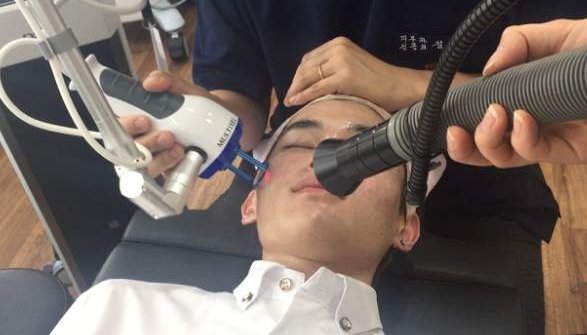 激光祛痘坑大概多少钱