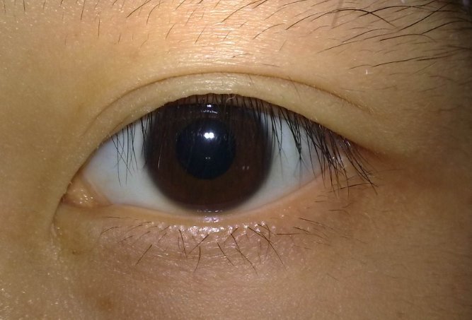 左眼跳灾，右眼跳财？