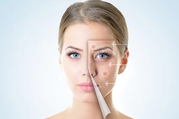 电波拉皮有没有副作用?