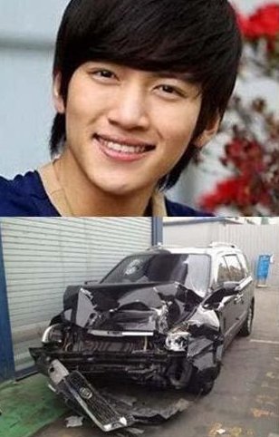 池昌旭为什么整容?