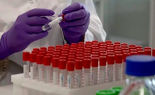 核酸检测阳性什么意思？