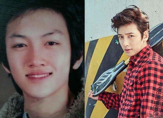 池昌旭为什么整容？