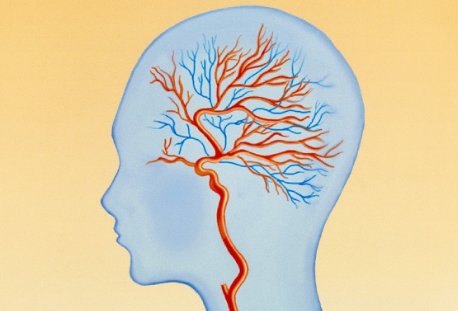 吗啡的药理作用是什么?有哪些危害?