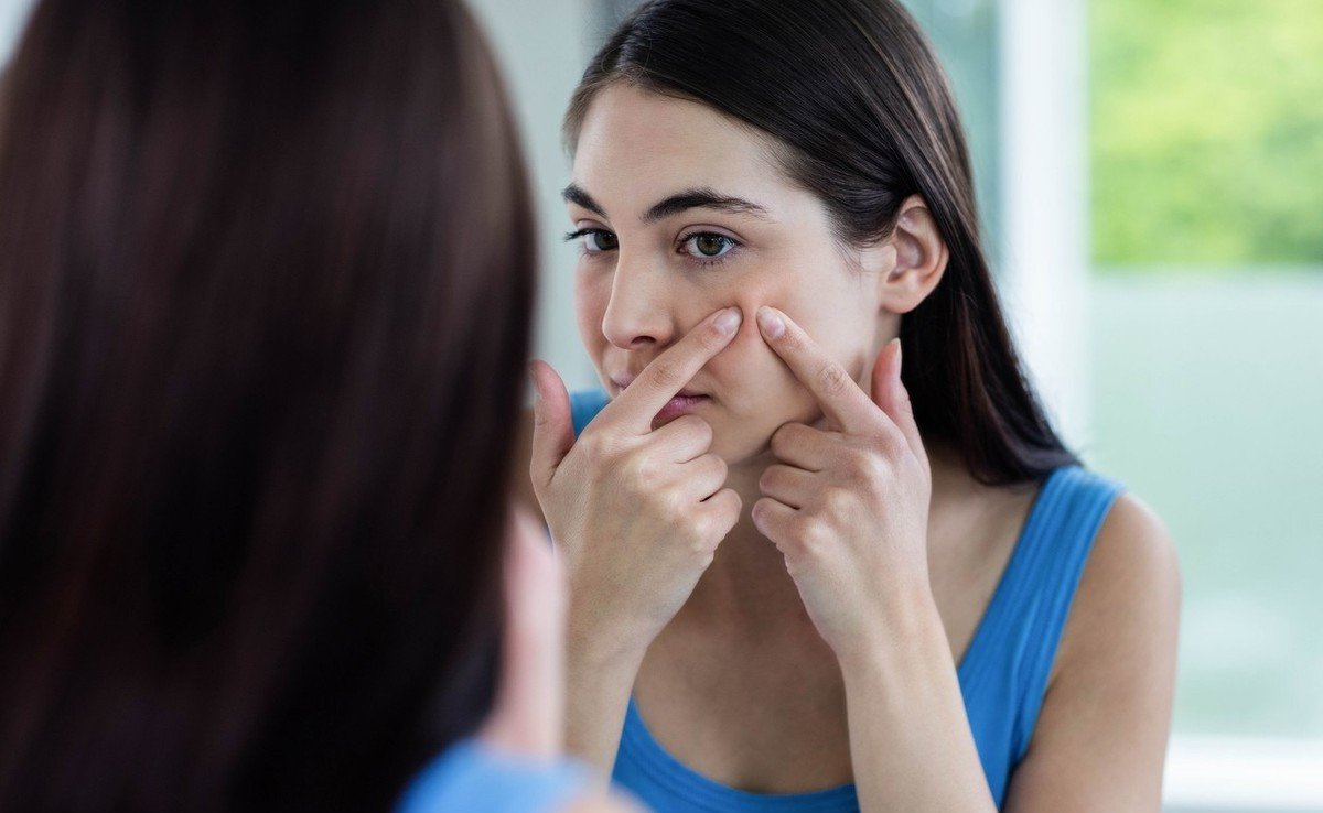 春天脸上过敏怎么缓解