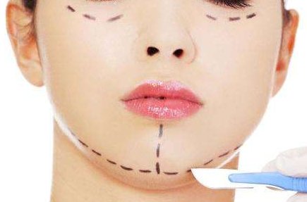 面部提升最好的方法有哪些