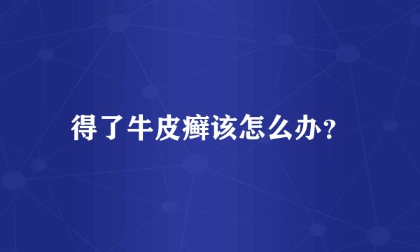 得了牛皮癣该怎么办？