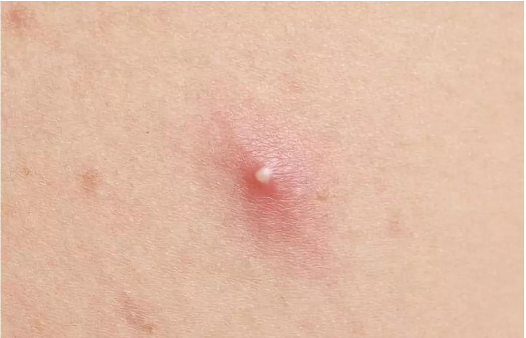 泰尔丝是什么？