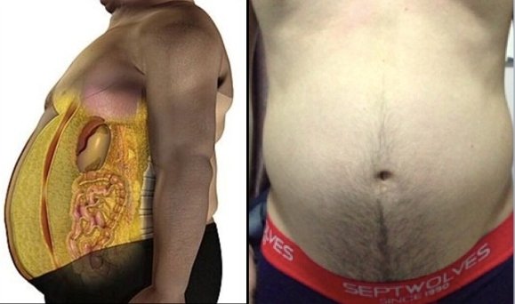 人体脂肪是怎么形成的？如何去消耗它?