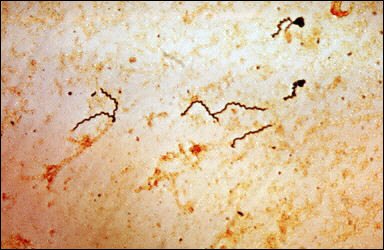 苍白密螺旋体的生物特性