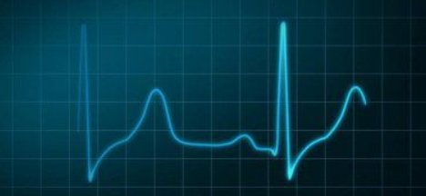 一安等于多少毫安